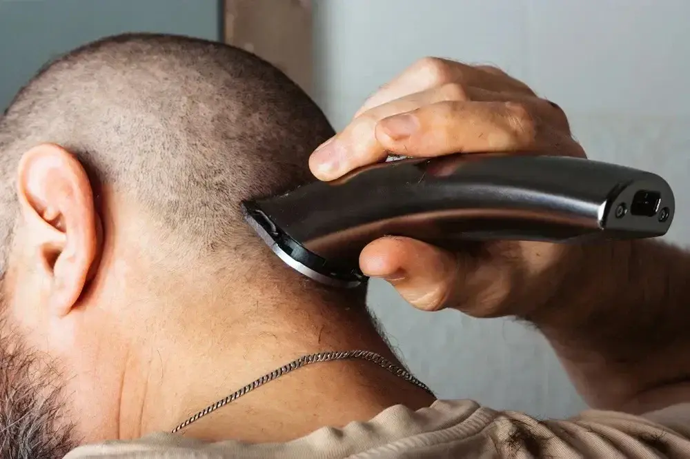 Shaving Head After Hair Transplant: Safe Timing Guide