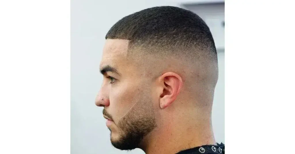 Buzz Cut After Hair Transplant: Safe Timing Guide