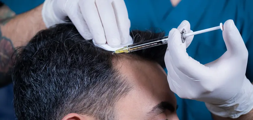Mesotherapy for Hair: Benefits, Cost, Safety