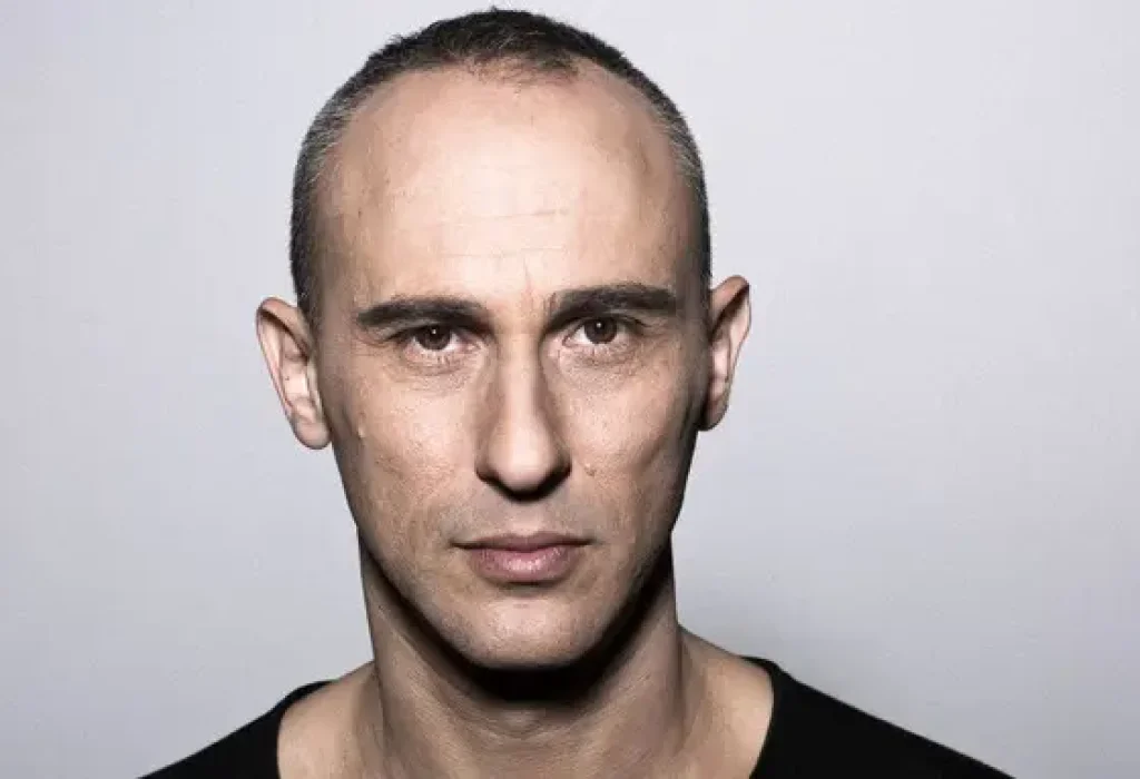 Assaf-Amdursky-hair-transplant (3)