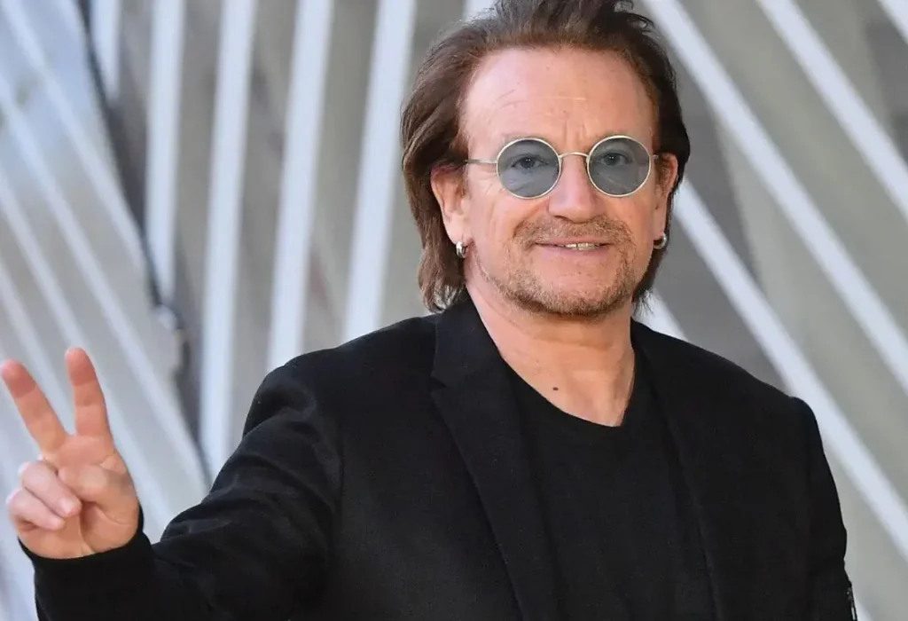 Bono-hair-transplant