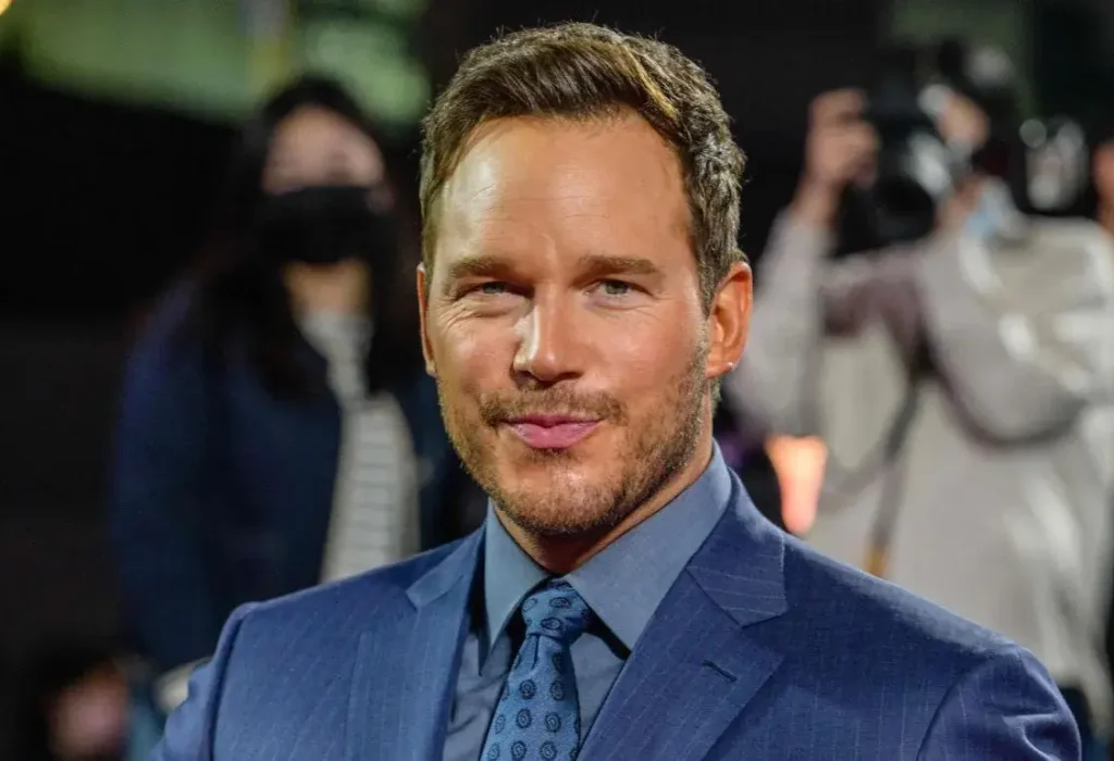 Chris-Pratt-hair-transplant