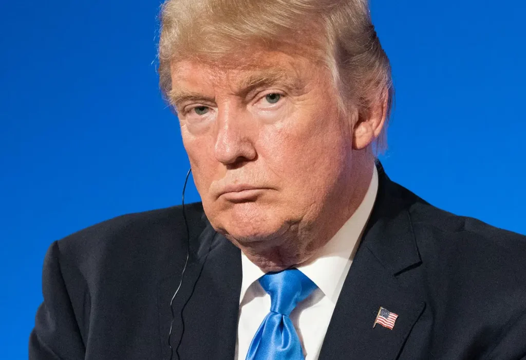 Donald-Trump-hair-transplant