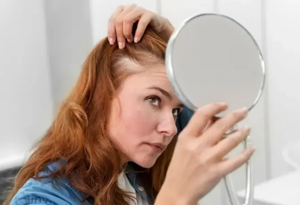 Hair-Transplant-for-Women-3