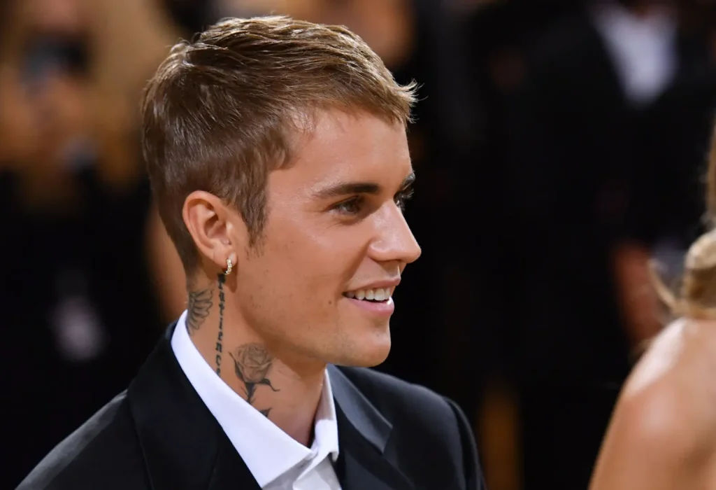 Justin-Bieber-hair-transplant-2
