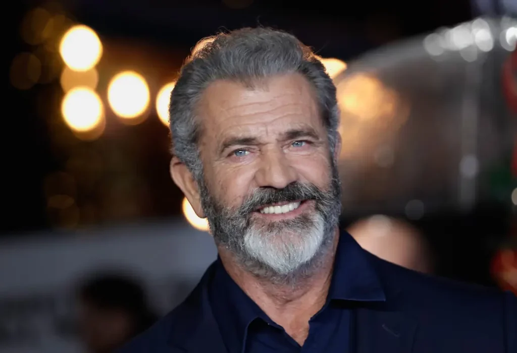 Mel-Gibson-hair-transplant-4