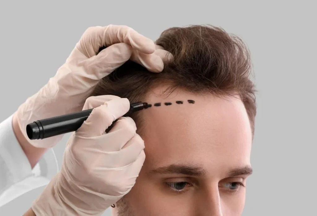 PROCEDURES