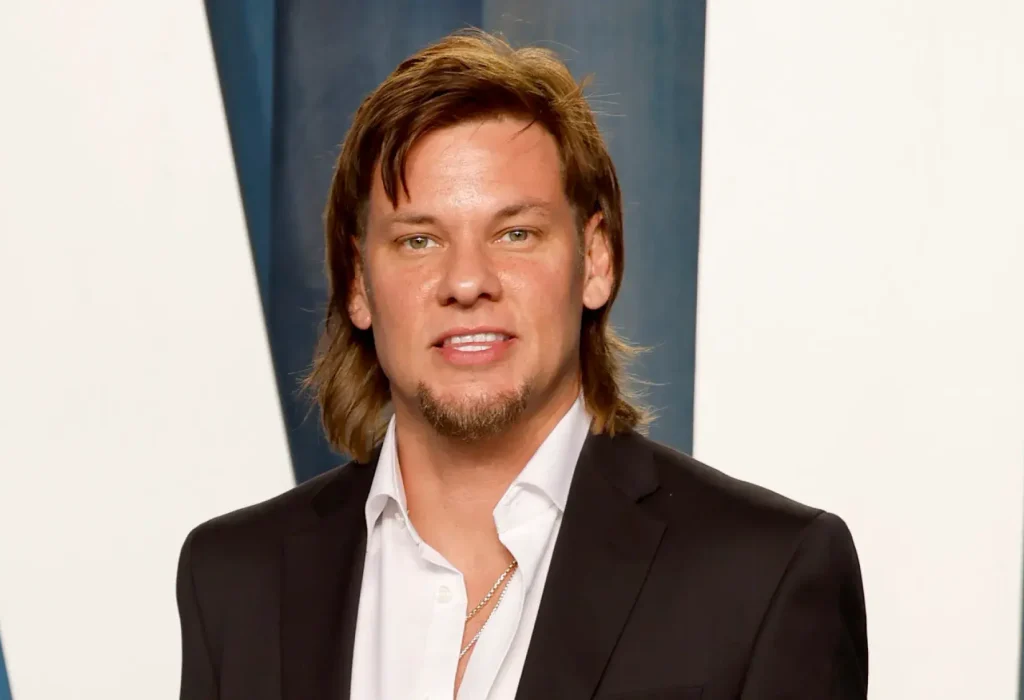 Theo-Von-hair-transplant-4