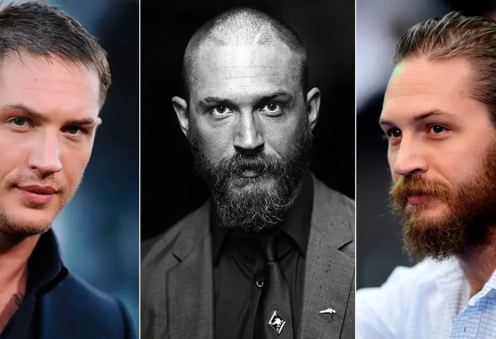 Tom-Hardy-hair-transplant-5 (1)