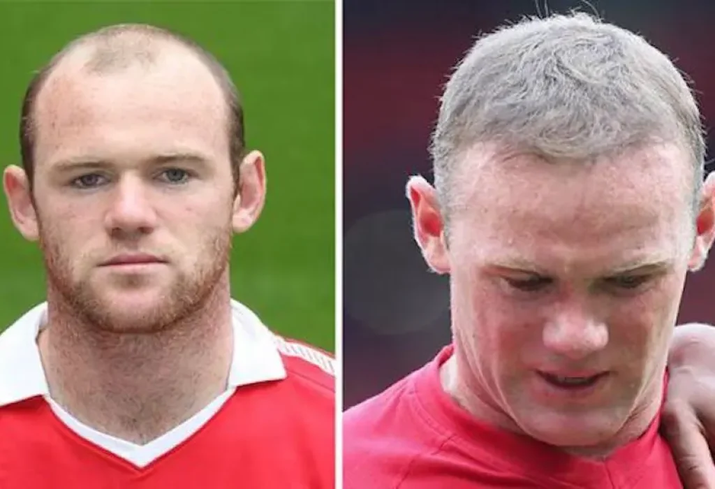 Wayne-Rooney