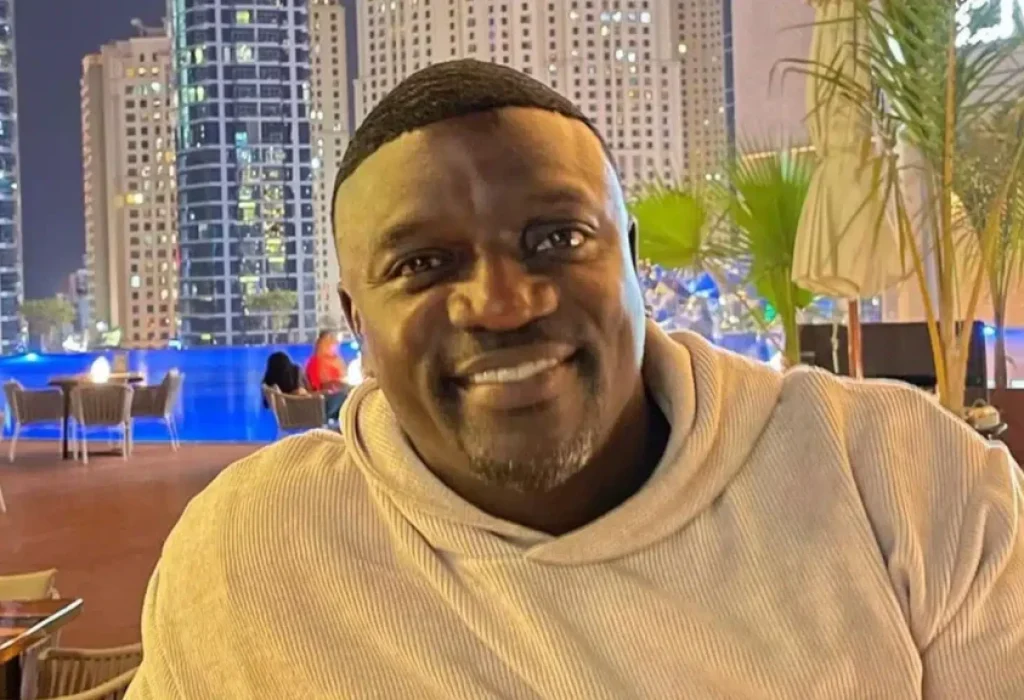 akon-hair-transplant