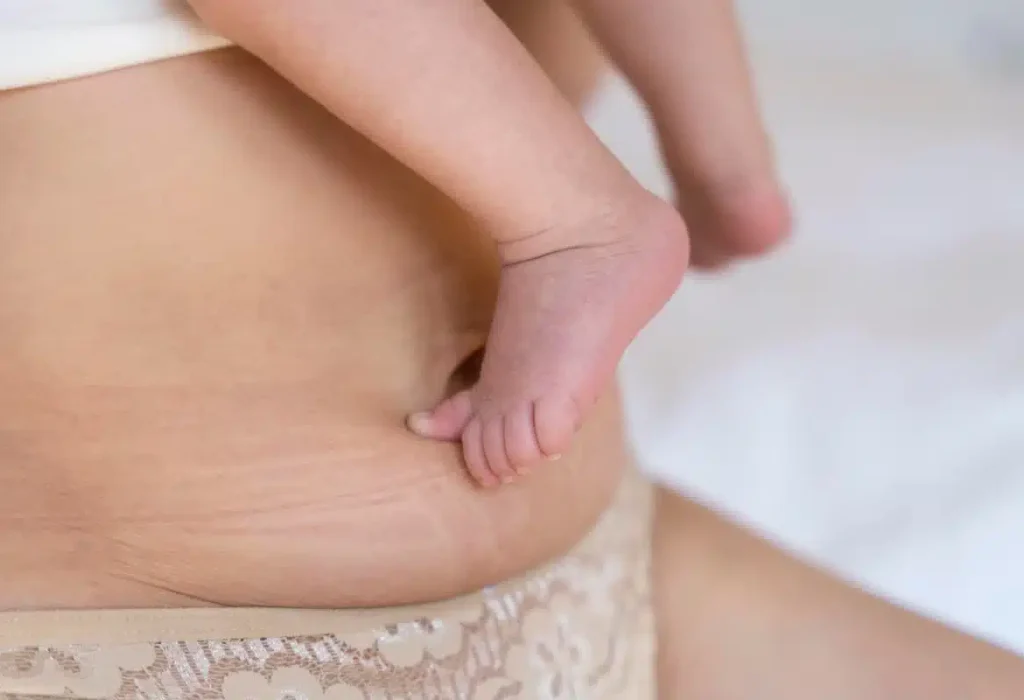 biotin-postpartum-hair-loss