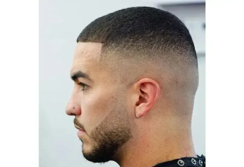 buzz-cut-after-hair-transplant-2