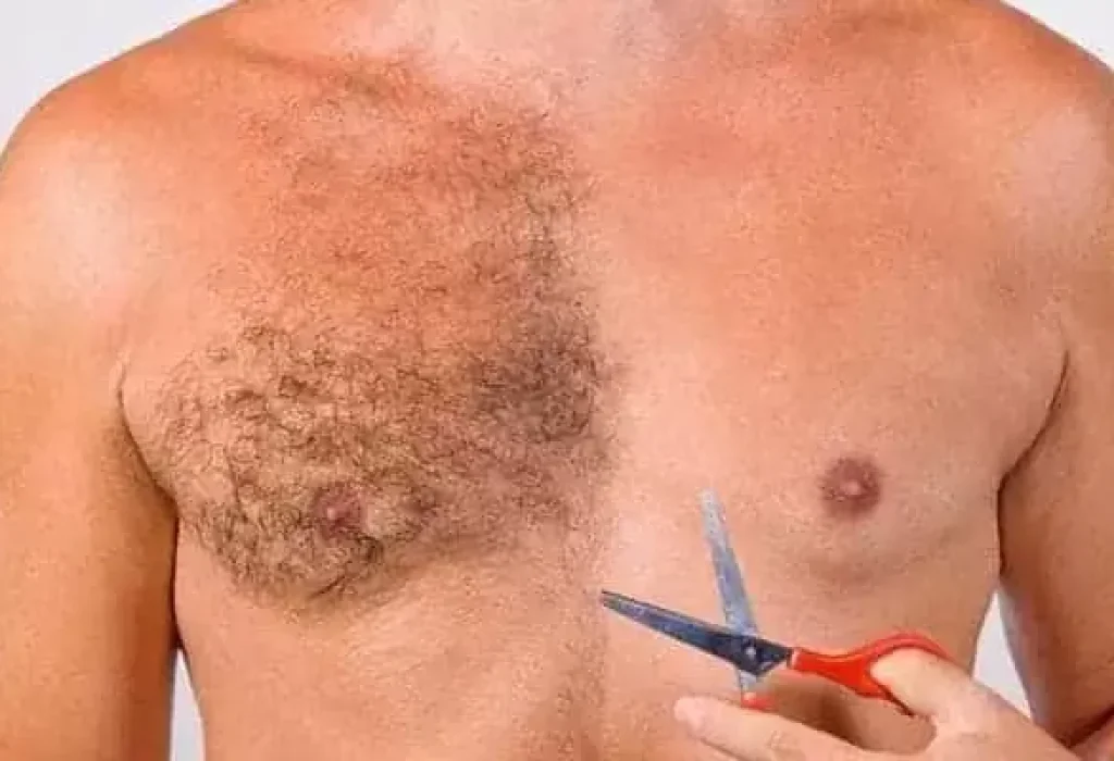chest-hair-for-hair-transplant