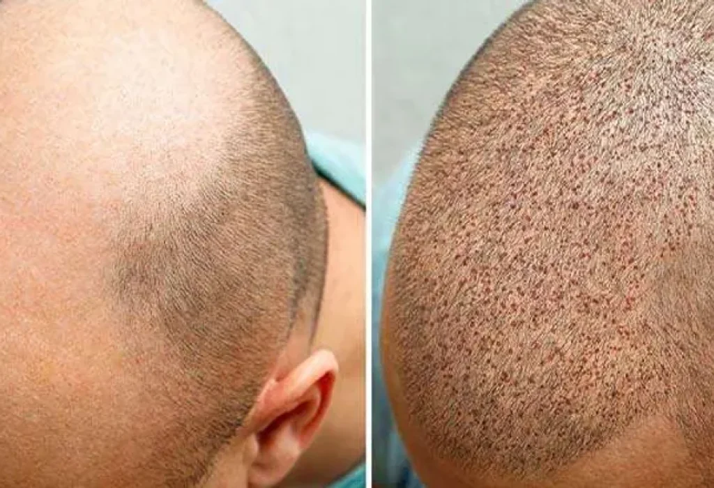 cost-hair