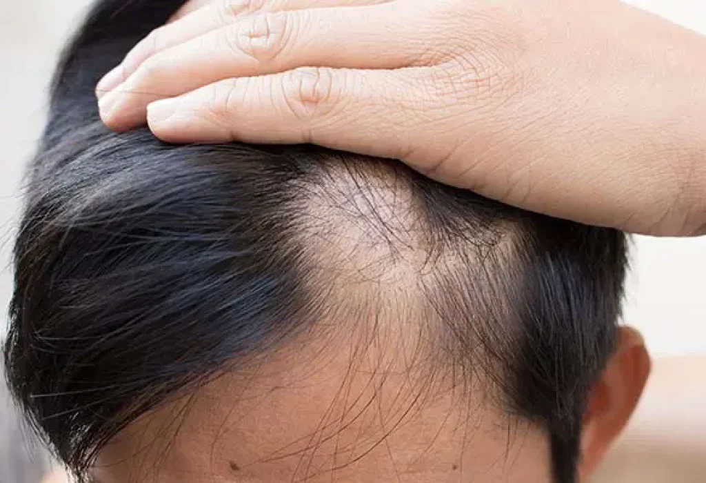 dermatologist-hair-loss-1