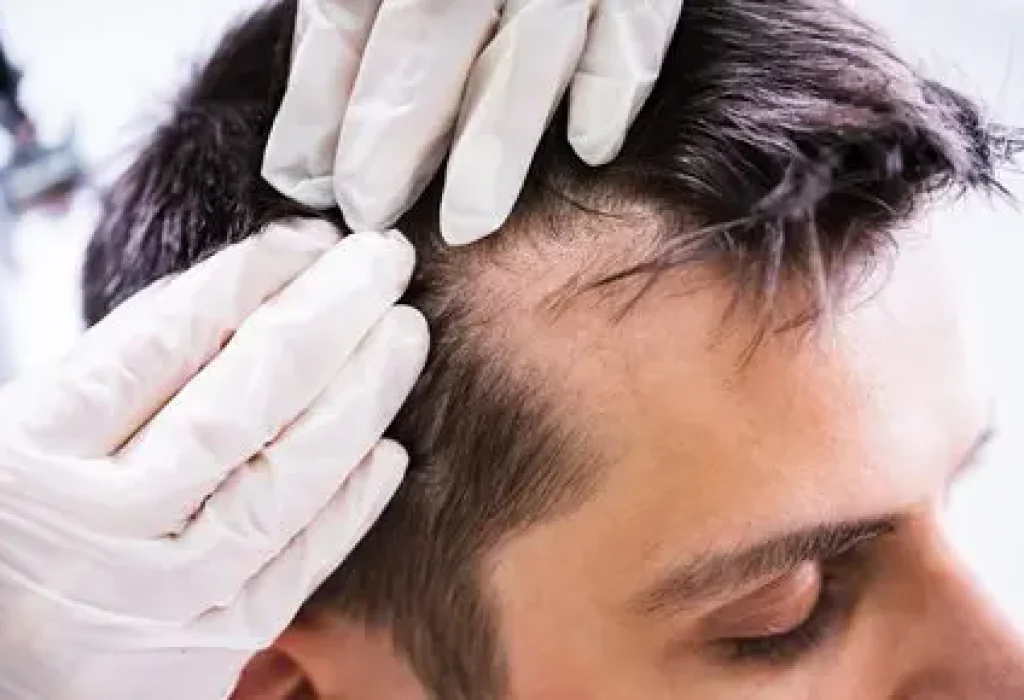 dermatologist-hair-loss