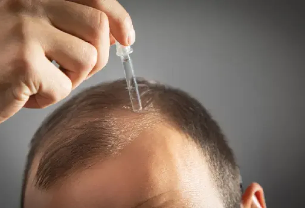 dutasteride-for-hair-loss