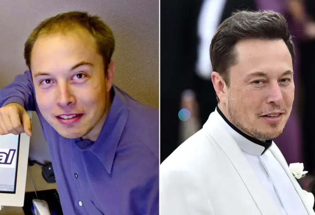 elon-before-and-after