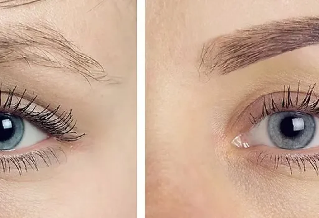 eyebrow-hair