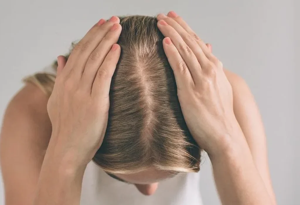 female-hair-loss-pattern