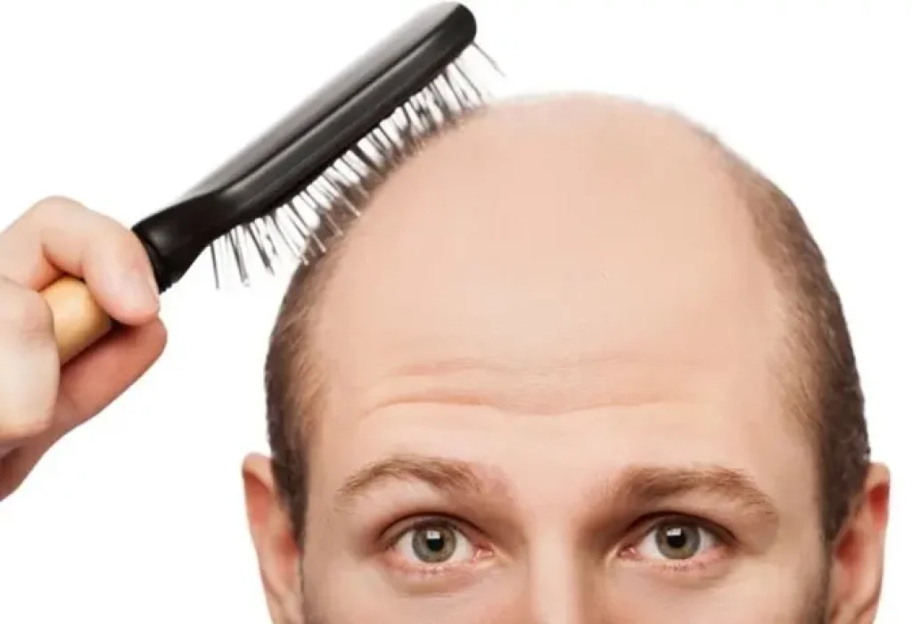 hair-loss-faqs-2