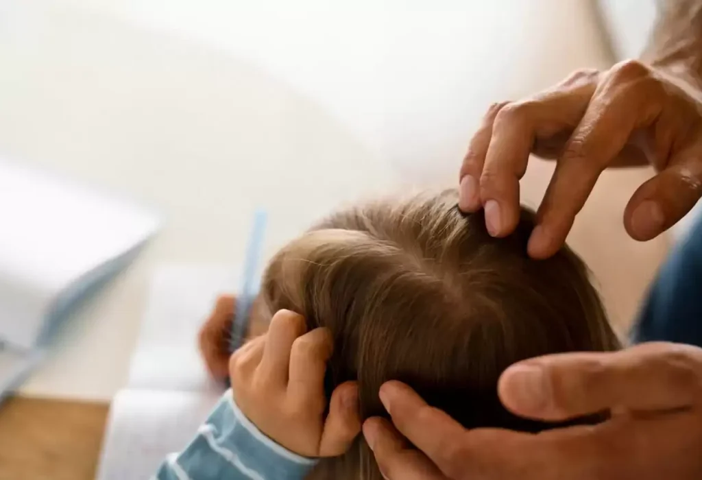 hair-loss-in-children