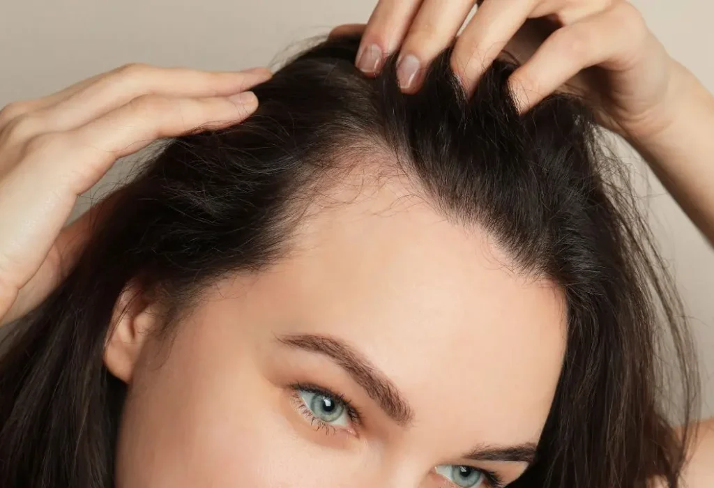 hair-transplant-for-women-in-turkey