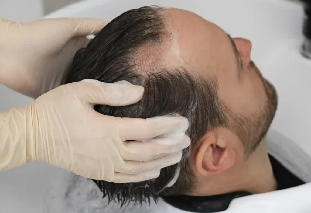 hair-wash-bald