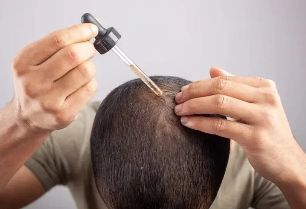 minoxidil