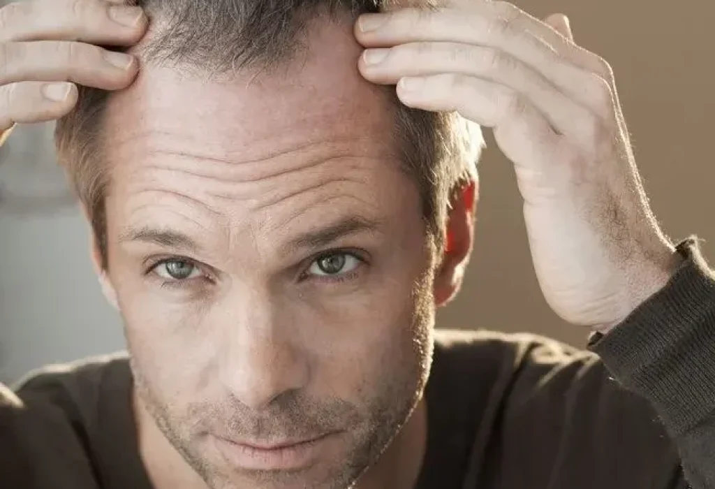 painful-scalp-1