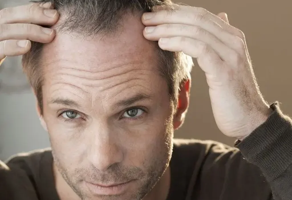 painful-scalp-1