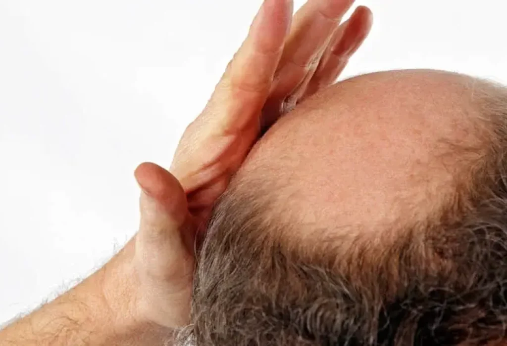 painful-scalp