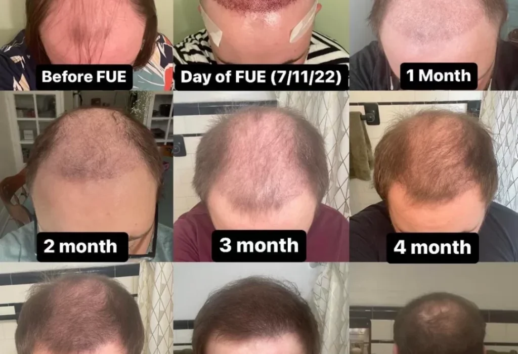 reached-the-6-month-mark-since-fue-v0-ux157qn644da1-972x1024