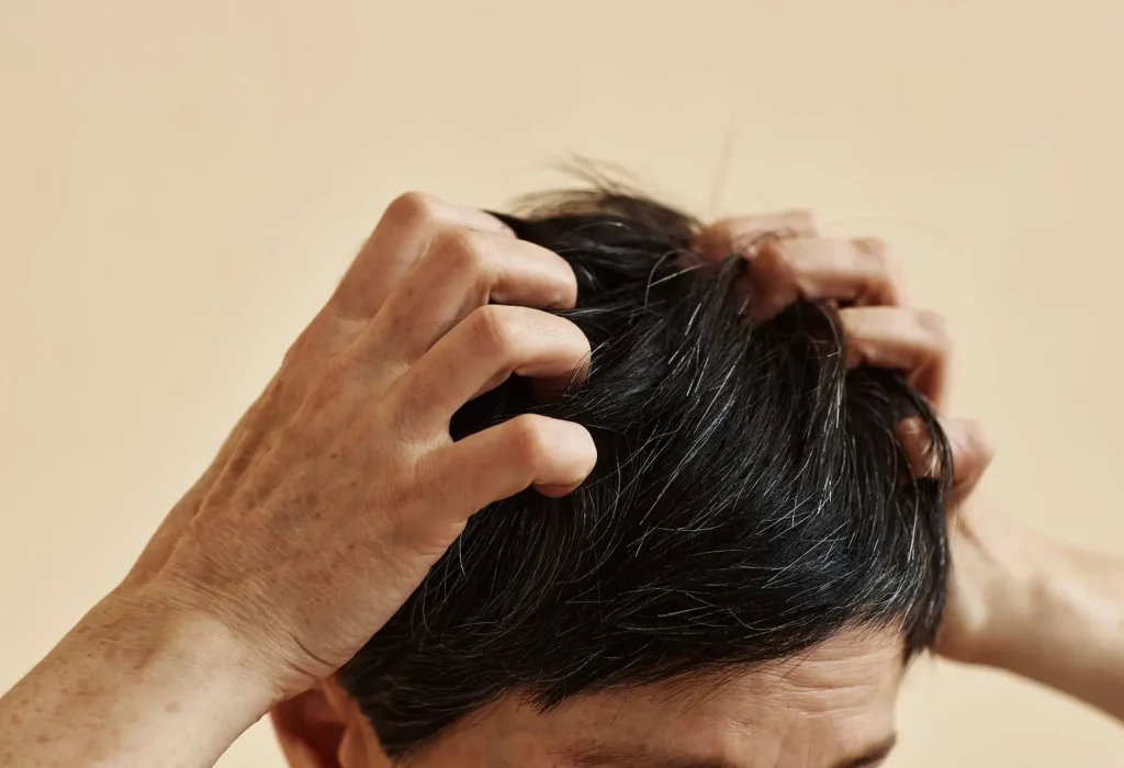scalp-itching-and-hair-loss