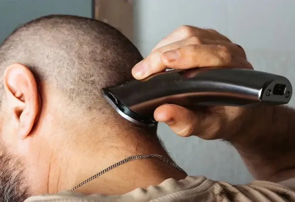 shaving-head-after-hair-transplant