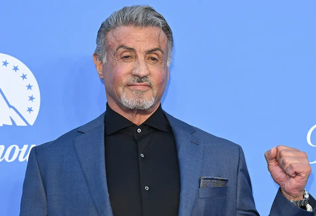 sylvester-stallone-hair-transplant-2