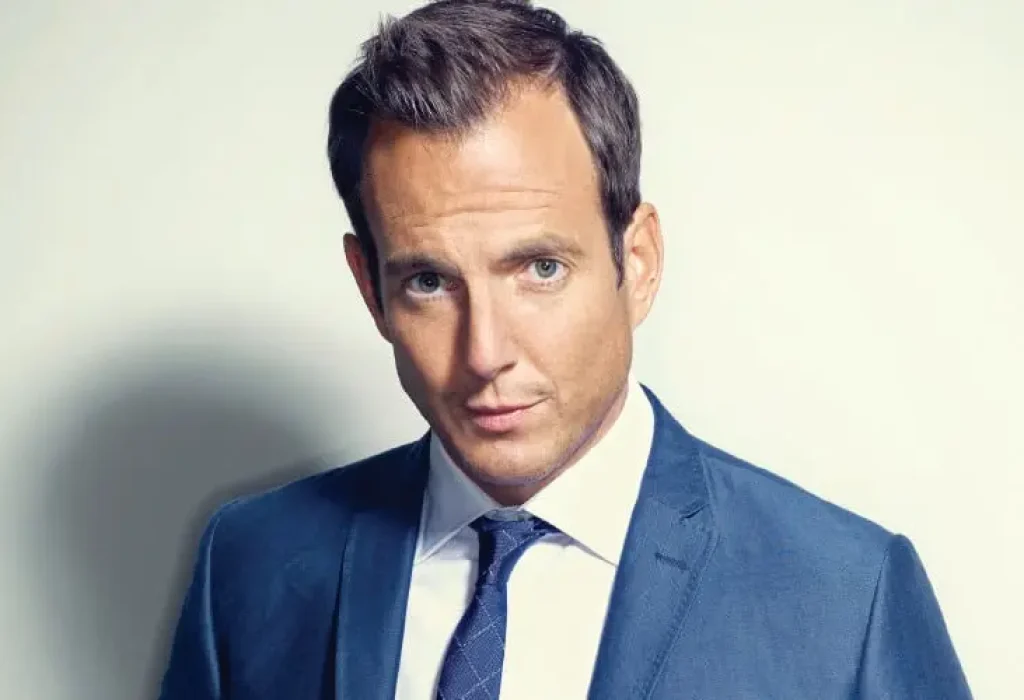 will-arnett-hair-transplant-3